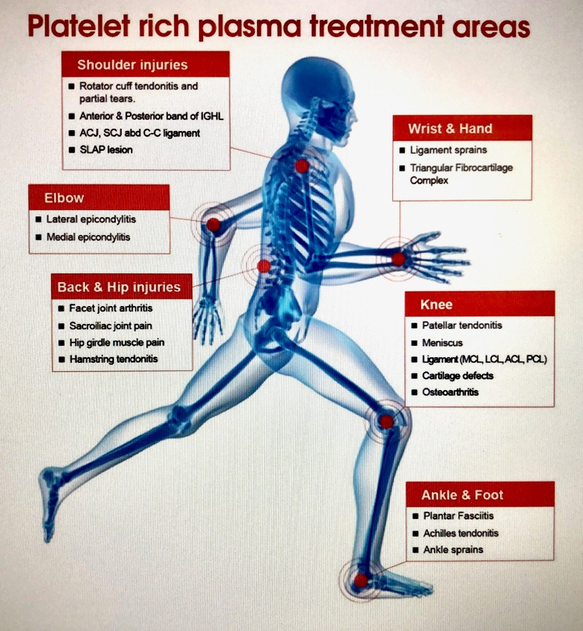 PRP Treatment Aras