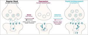 How Ketamine Works